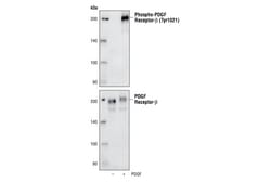 Cell Signaling Technology&nbsp;Phospho-PDGF Receptor beta Ty