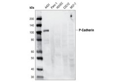 Cell Signaling Technology&nbsp;P-Cadherin C13F9 Rabbit mAb