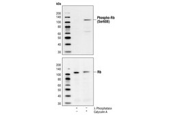 Cell Signaling Technology&nbsp;Phospho-Rb Ser608 Antibody 2