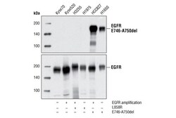 Cell Signaling Technology&nbsp;EGF Receptor E746-A750del Spe