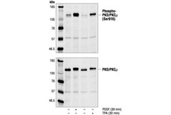 Cell Signaling Technology&nbsp;Phospho-PKD/PKC-mu Ser916 An