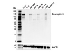 Cell Signaling Technology&nbsp;Desmoglein 3 5G11 Mouse mAb