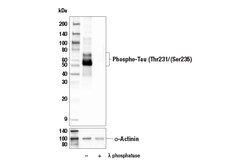 Cell Signaling Technology&nbsp;Phospho-Tau Thr231/Ser235 E