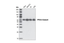 Cell Signaling Technology&nbsp;PP2A A Subunit 81G5 Rabbit m