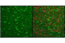 Cell Signaling Technology&nbsp;LC3B E5Q2K Mouse mAb BSA an