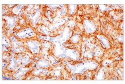 Cell Signaling Technology&nbsp;Periostin E5F2S Rabbit mAb 2