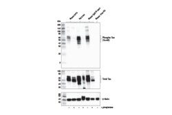 Cell Signaling Technology&nbsp;Phospho-Tau Ser46 Antibody 1