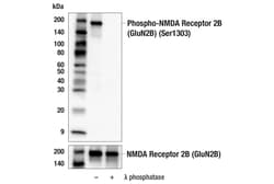 Cell Signaling Technology&nbsp;Phospho-NMDA Receptor 2B GluN