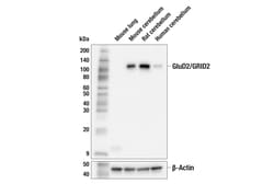 Cell Signaling Technology&nbsp;GluD2/GRID2 E4I9V Rabbit mAb