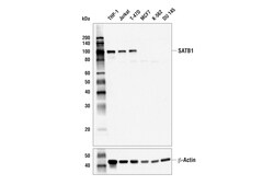 Cell Signaling Technology&nbsp;SATB1 E5Z3U Rabbit mAb 100 u
