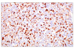 Cell Signaling Technology&nbsp;FcRn E4D5I Rabbit mAb 100 ul