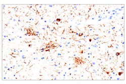 Cell Signaling Technology&nbsp;Phospho-Tau Thr205 E3E3B M