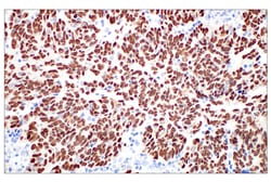 Cell Signaling Technology&nbsp;MAGE-C2/CT10 E7B8D XPR Rab