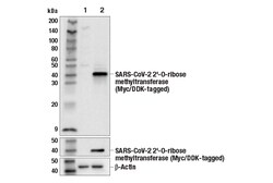Cell Signaling Technology&nbsp;SARS-CoV-2 2-O-ribose Methylt