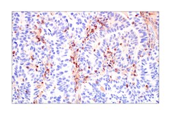 Cell Signaling Technology&nbsp;PI3 Kinase p110 delta E2T2N