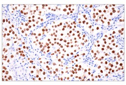 Cell Signaling Technology&nbsp;Sall4 6E3 Mouse mAb 100 ul