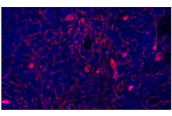 Cell Signaling Technology&nbsp;CD141/Thrombomodulin E7Y9P X
