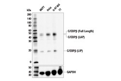 Cell Signaling Technology&nbsp;C/EBP-beta E7E5D Rabbit mAb