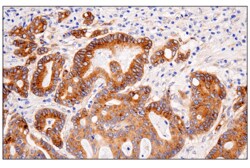 Cell Signaling Technology&nbsp;APP E3F3P Rabbit mAb 100 ul