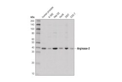 Cell Signaling Technology&nbsp;Arginase-2 Antibody 100 ul