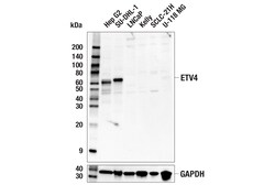 Cell Signaling Technology&nbsp;ETV4 E5Q1U Rabbit mAb 100 ul
