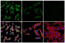 Cell Signaling Technology&nbsp;IL-6R-alpha/CD126 E5B3P Rabb