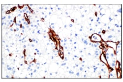 Cell Signaling Technology&nbsp;COL4A1 E5M6R Rabbit mAb IHC