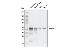 Cell Signaling Technology&nbsp;ALDH2 Antibody 100 ul