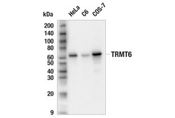 Cell Signaling Technology&nbsp;TRMT6 E7L3M Rabbit mAb 100 u