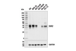 Cell Signaling Technology&nbsp;SIX2 E7C3J Rabbit mAb 100 ul