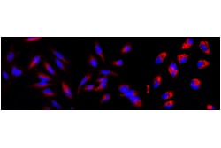 Cell Signaling Technology&nbsp;LC3B E5Q2K Mouse mAb Alexa