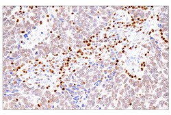 Cell Signaling Technology&nbsp;RUNX3/AML2 E8D5W XPR Rabbi