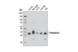 Cell Signaling Technology&nbsp;Podoplanin D9D7 Rabbit mAb