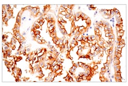 Cell Signaling Technology&nbsp;TPBG/5T4 E3M5R XPR Rabbit