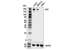 Cell Signaling Technology&nbsp;DCC E4U1X Rabbit mAb 100 ul