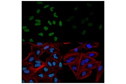 Cell Signaling Technology&nbsp;PQBP1 E5N7J Rabbit mAb 100 u