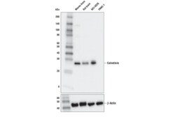 Cell Signaling Technology&nbsp;Calretinin E9R6G Rabbit mAb