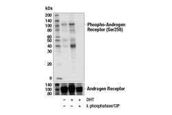 Cell Signaling Technology&nbsp;Phospho-Androgen Receptor Ser