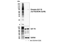 Cell Signaling Technology&nbsp;Phospho-SLP-76 Tyr145/BLNK