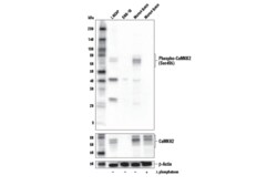 Cell Signaling Technology&nbsp;Phospho-CaMKK2 Ser495 Antibo