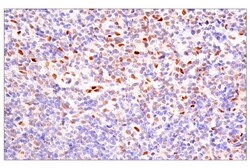 Cell Signaling Technology&nbsp;Bcl-3 E4D4K Rabbit mAb 100 u
