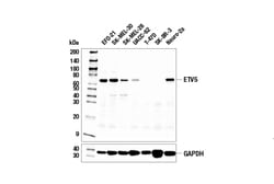 Cell Signaling Technology&nbsp;ETV5 E5G9V Rabbit mAb 100 ul