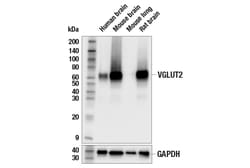 Cell Signaling Technology&nbsp;VGLUT2 E2V4W Rabbit mAb 100