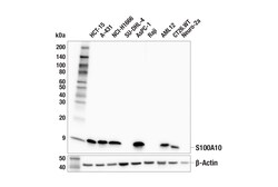Cell Signaling Technology&nbsp;S100A10 Antibody 100 ul
