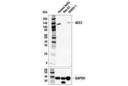 Cell Signaling Technology&nbsp;ACE2 OTI1D6 Mouse mAb 100 ul