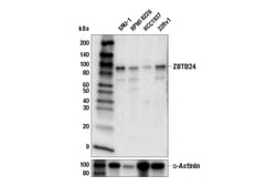 Cell Signaling Technology&nbsp;ZBTB24 E5D6G Rabbit mAb 100