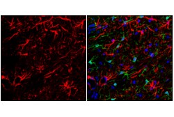 Cell Signaling Technology&nbsp;GFAP E4L7M XPR Rabbit mAb