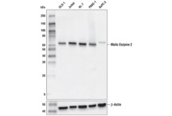 Cell Signaling Technology&nbsp;Malic Enzyme 2 E1N3E XPR R