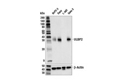 Cell Signaling Technology&nbsp;ULBP2 E6S7D Rabbit mAb 100 u
