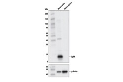 Cell Signaling Technology&nbsp;Ly6k Antibody 100 ul